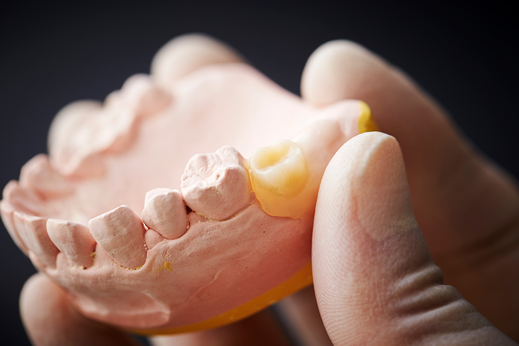 薬円台・古池歯科・一般的な治療はもちろん、専門的な義歯治療にも対応いたします
